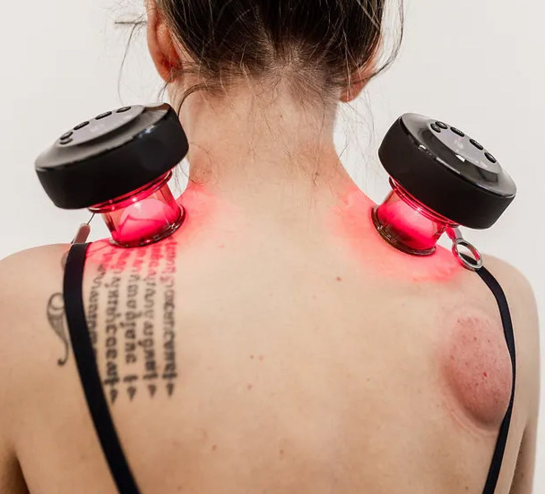 Lieferumfang des Aerify Dynamic Cupping: Gerät, Becher, Fernbedienung, Hartschalenkoffer, Ladekabel und Sicherheitsband